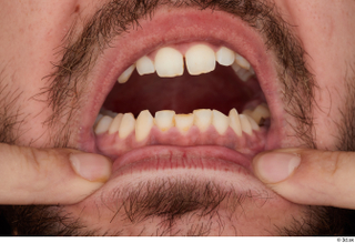 Hamza teeth 0003.jpg